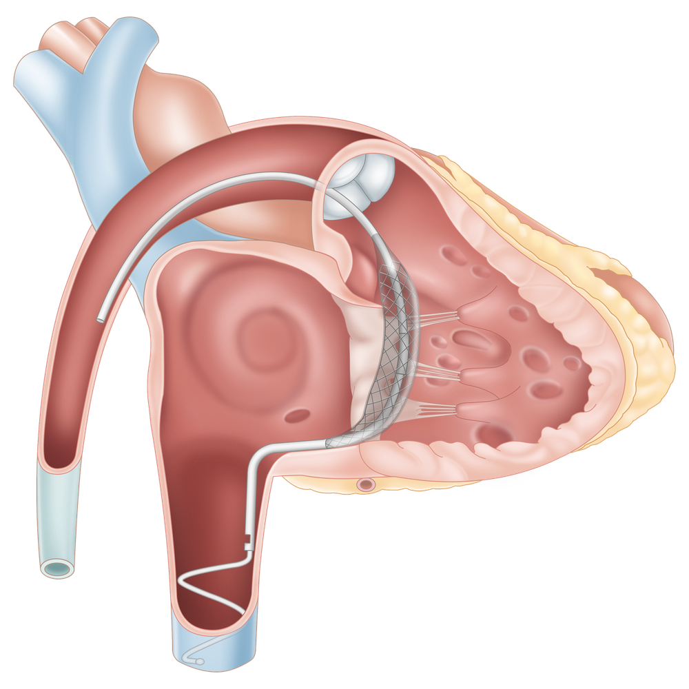 Pivot Extend device
